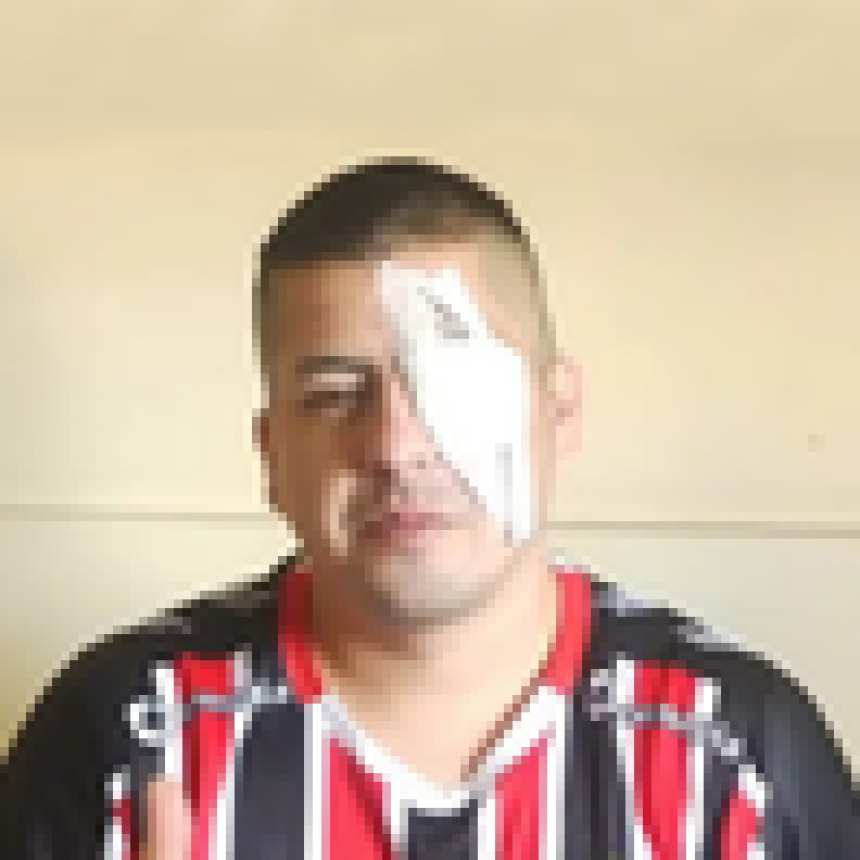 Un ojo no es tanto para Patricia Bullrich